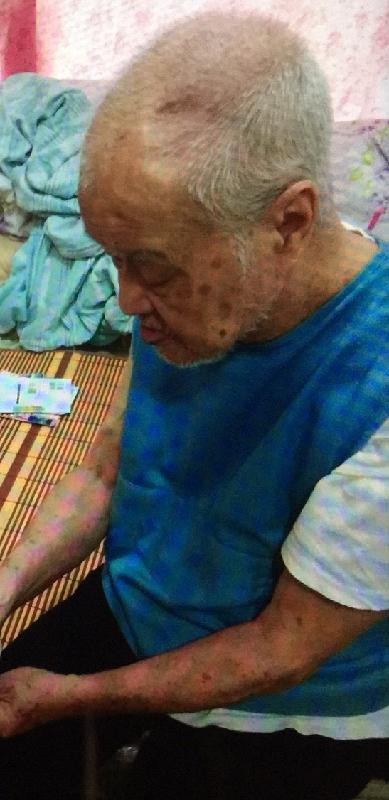 Tang Yee-cheung, aged 80, is about 1.65 metres tall, 59 kilograms in weight and of medium build. He has a square face with yellow complexion and short white hair. The left side of his head is sagged. He was last seen wearing a white short-sleeved T-shirt, red checker trousers and blue slippers.