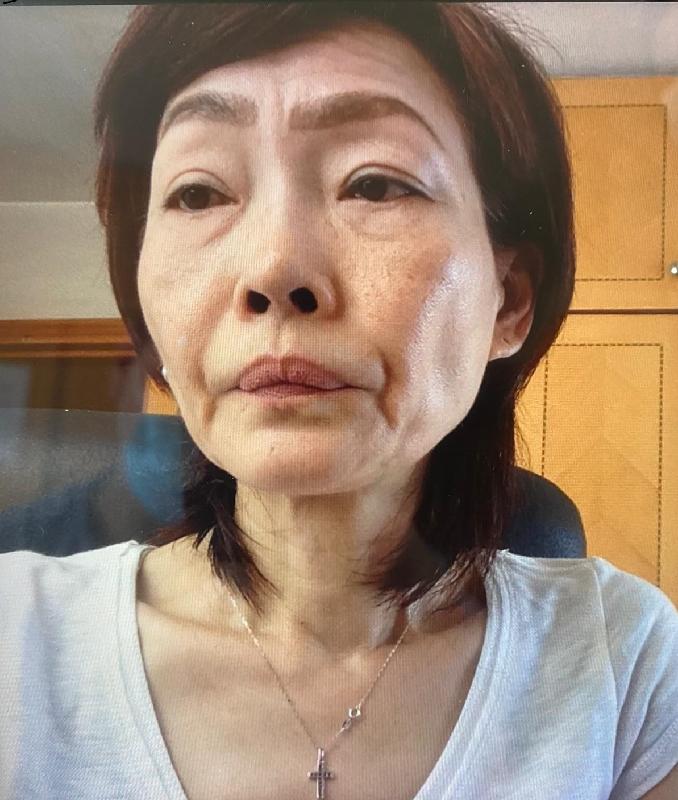 Cheng Pui-wan, aged 57, is about 1.6 metres tall, 50 kilograms in weight and of thin build. She has a pointed face with yellow complexion and short dark brown hair. She was last seen wearing a grey long-sleeved shirt, black trousers and silver-coloured shoes.