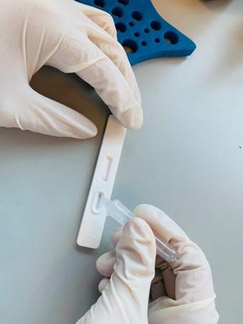 英諾診斷有限公司研發的新型冠狀病毒診斷試劑，旨在協助醫療機構和檢測實驗室等進行新型冠狀病毒快速測試。項目獲香港大學提供試用場地。