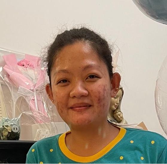 Verdillo Arjoy Roxas, aged 31, is about 1.65 metres tall, 55 kilograms in weight and of medium build. She has a square face with yellow complexion and short black hair. She was last seen wearing a black jacket, white vest, yellow skirt and white sports shoes.
