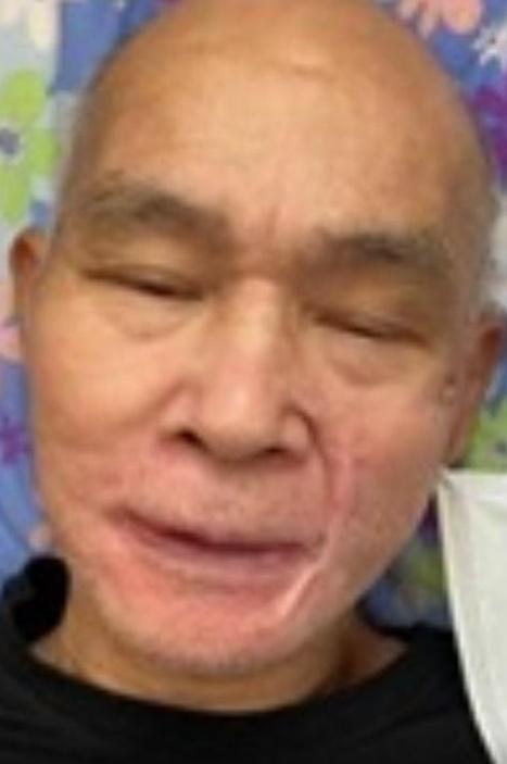 Ku On-leung, aged 79,  is about 1.7 metres tall, 60 kilograms in weight and of thin build. He has a pointed face with yellow complexion and is bald. He was last seen wearing a blue, white and grey short-sleeved shirt, blue trousers and yellow sandals.