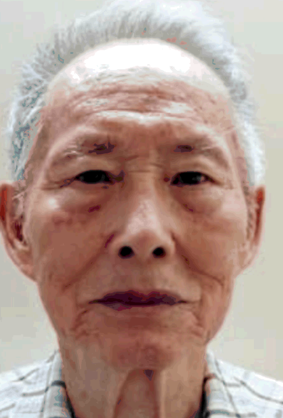Choy Hoi-wan, aged 75, 1.65 metres tall, 50 kilograms in weight and of thin build. He has a pointed face with yellow complexion and short white hair. He was last seen wearing a green checkered shirt, blue trousers, brown shoes and carrying a red umbrella.