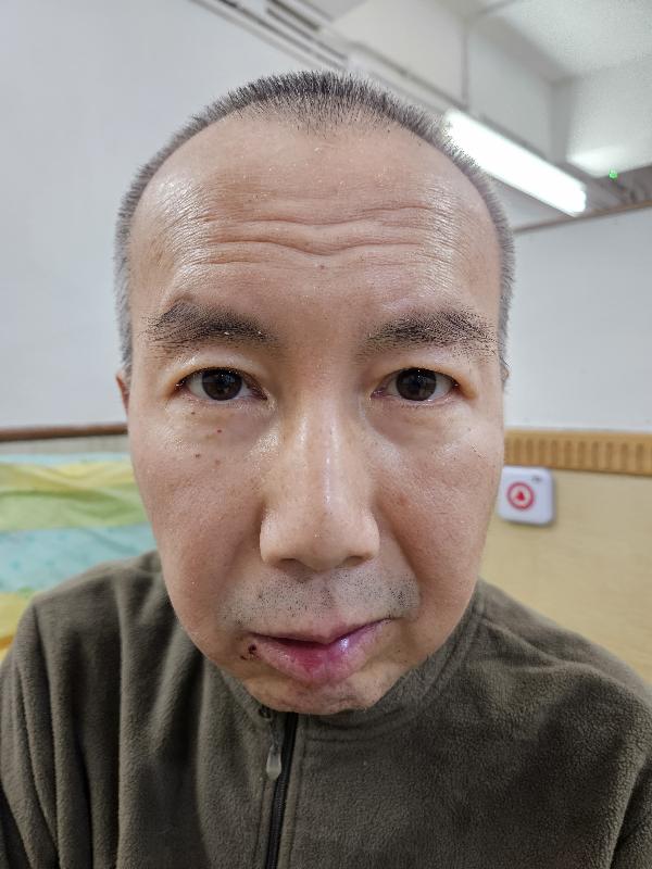六十一歲男子蔡木倫身高約一點七米，體重約六十公斤，中等身材，圓面型，黃皮膚及蓄短黑髮。他最後露面時身穿藍色短袖上衣、印有碎花圖案的短褲及黑色運動鞋。
