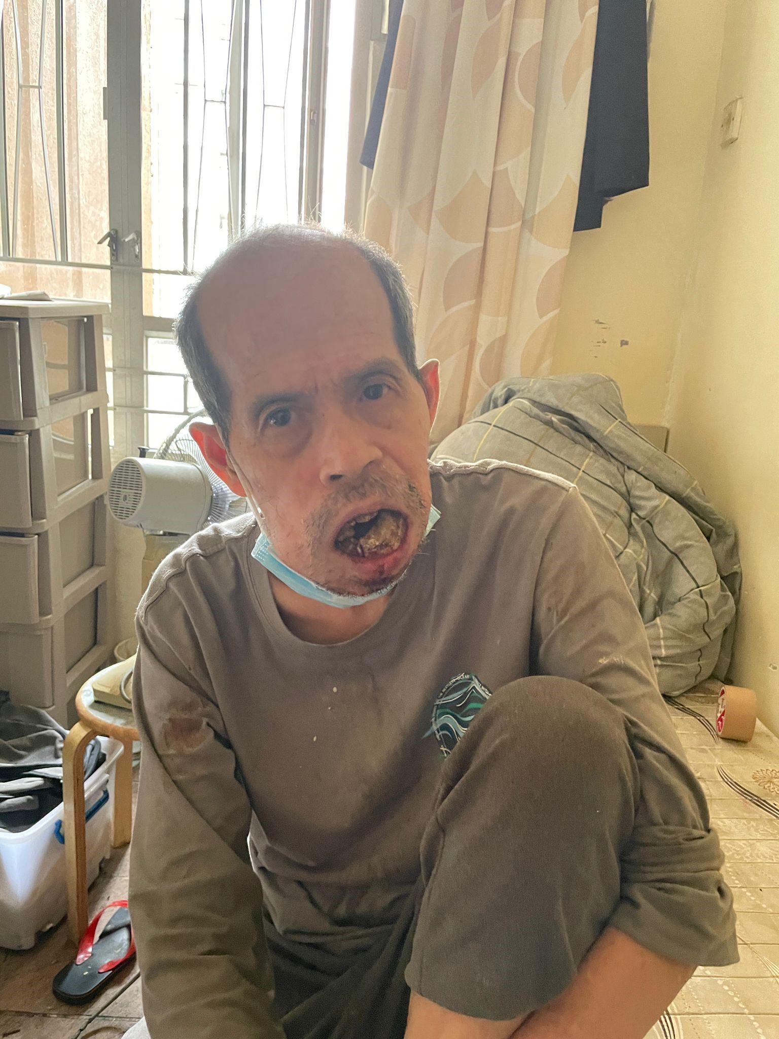 鄧仕鑾, 六十四歲男子, 身高約一點七八米，瘦身材，長面型，黃皮膚，禿頭及兩側蓄短灰髮。他最後露面時身穿淺綠色短袖衫、黑色長褲及白色運動鞋，戴淺藍色口罩，並攜有一個黑色背囊。