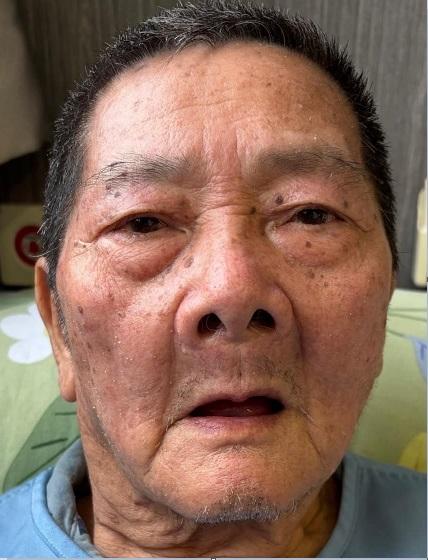 Ng Chi-hung, aged 82, is about 1.56 metres tall, around 59 kilograms in weight and of thin build. He has a round face with yellow complexion and short black hair. He was last seen wearing a grey short-sleeved shirt, grey trousers, black shoes and a white mask.